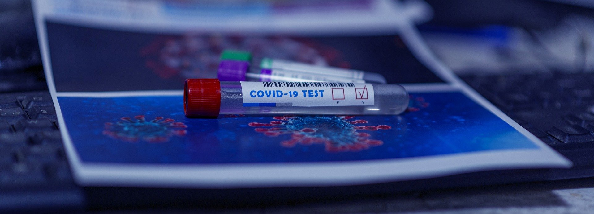COVID-19 – Indonesia-UEA kerja sama teknologi deteksi penularan virus