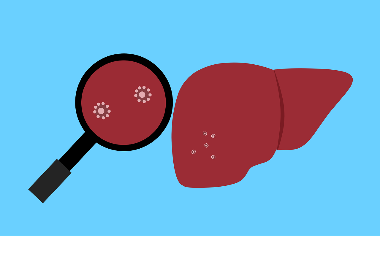 Fokus – Waspada! 3 anak meninggal akibat hepatitis akut