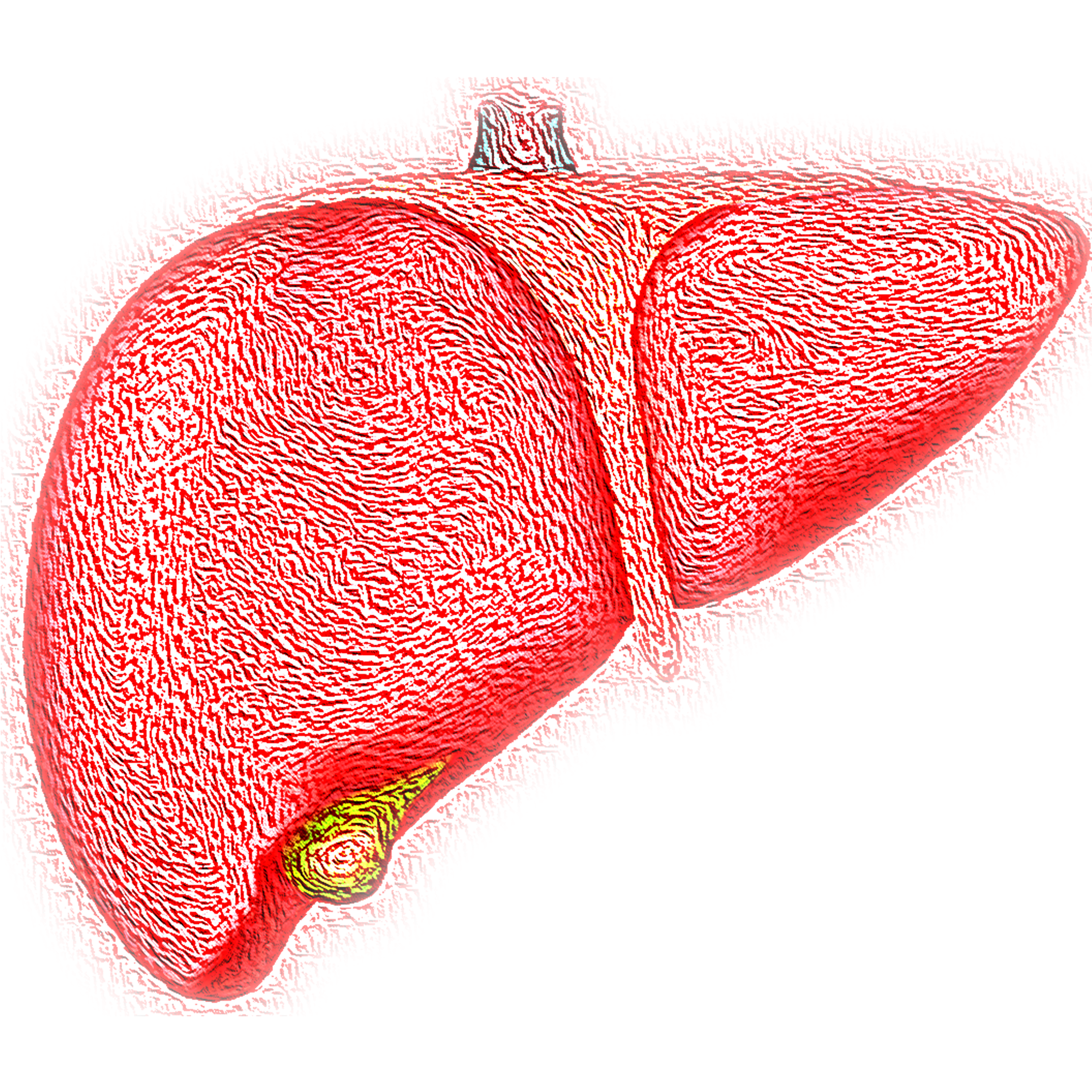 Roundup – Indonesia on alert for hepatitis following deaths of 3 children