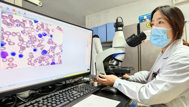 Diagnosis sindrom polikistik ovarium