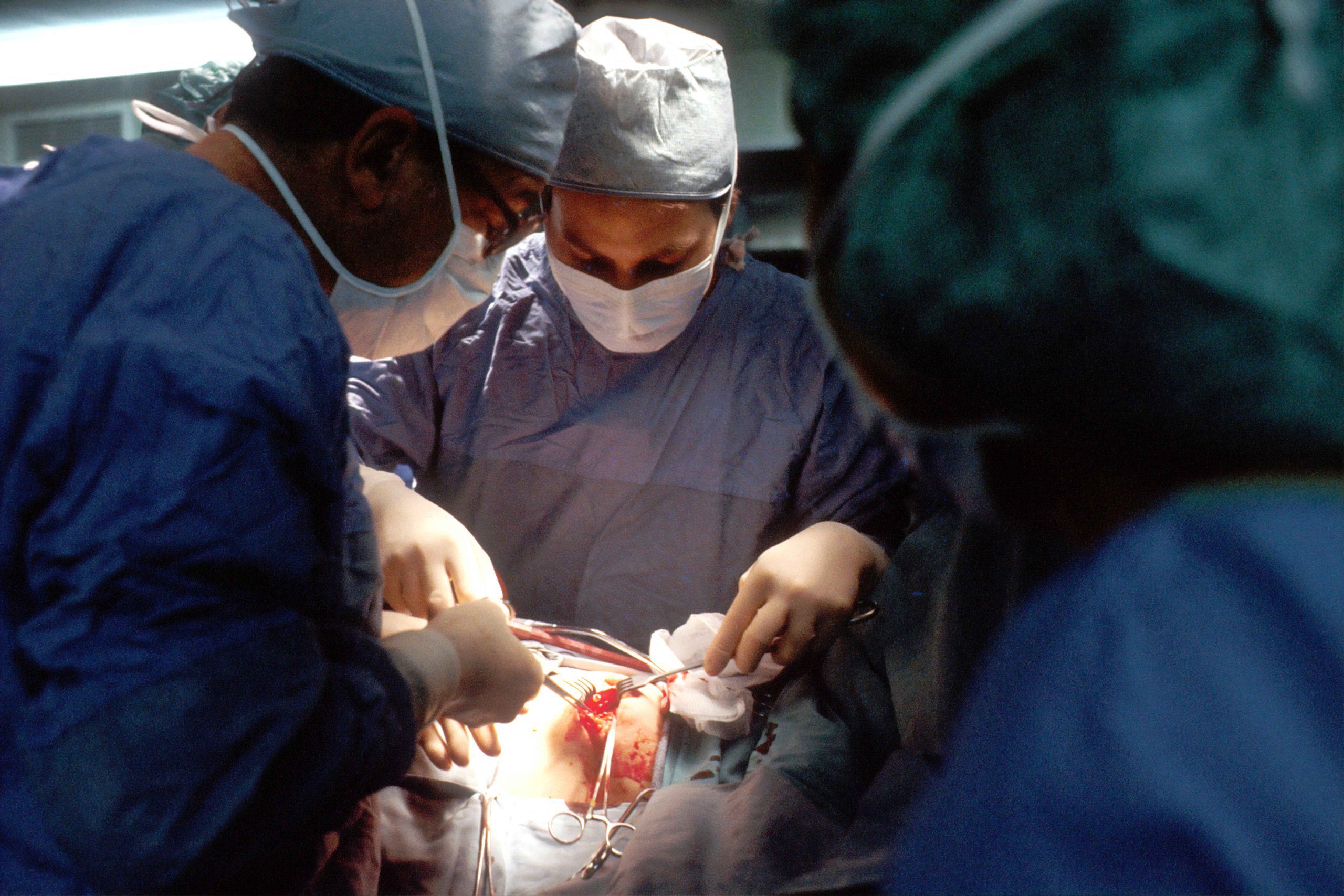 Peraturan transplantasi organ manusia