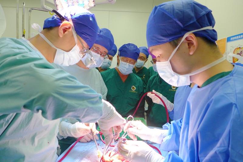Teknik transplantasi organ